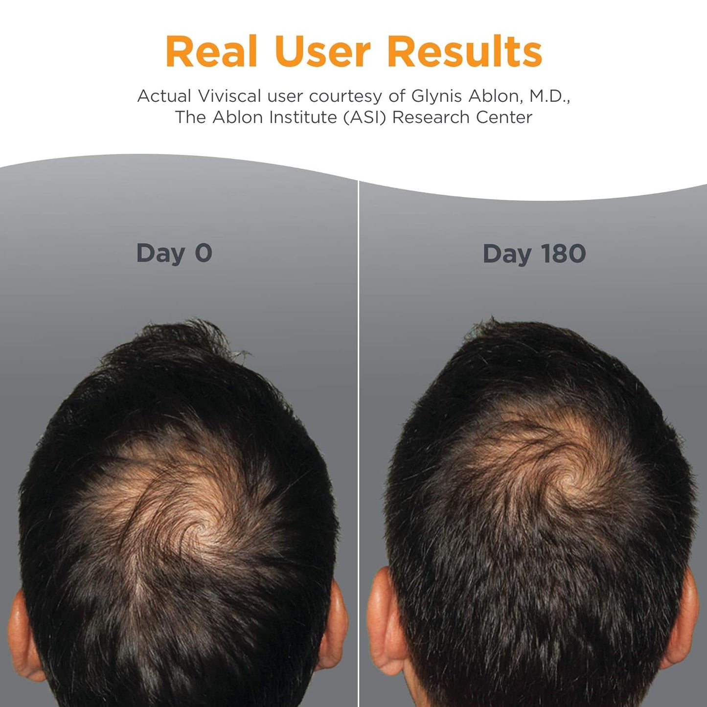Men's Hair Growth Supplement Viviscal™