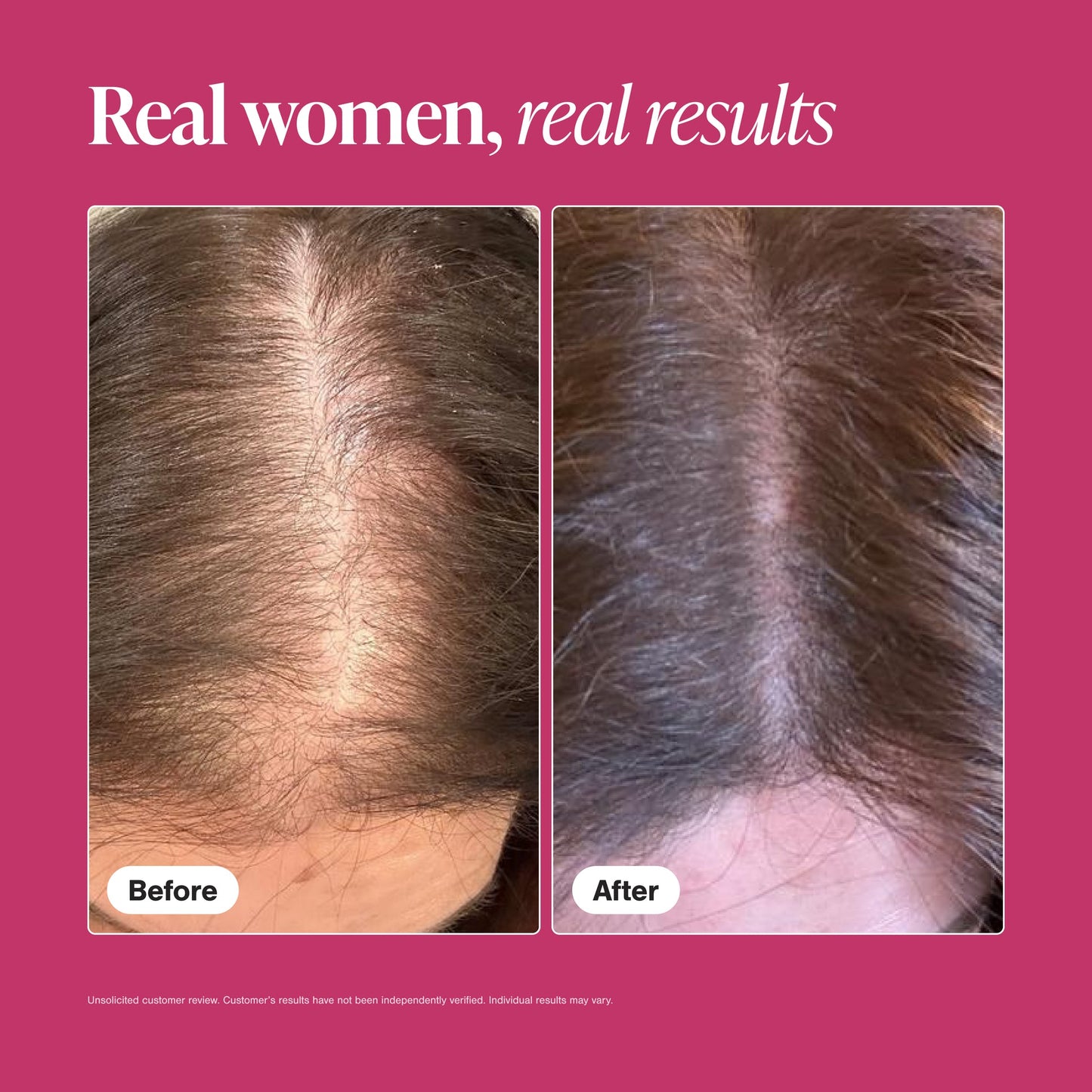 Hair Growth Supplement Viviscal™