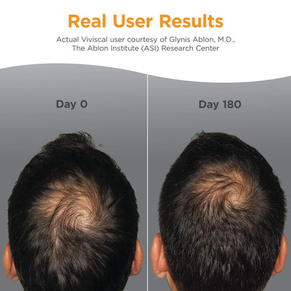 Men's Hair Growth Supplement Viviscal™
